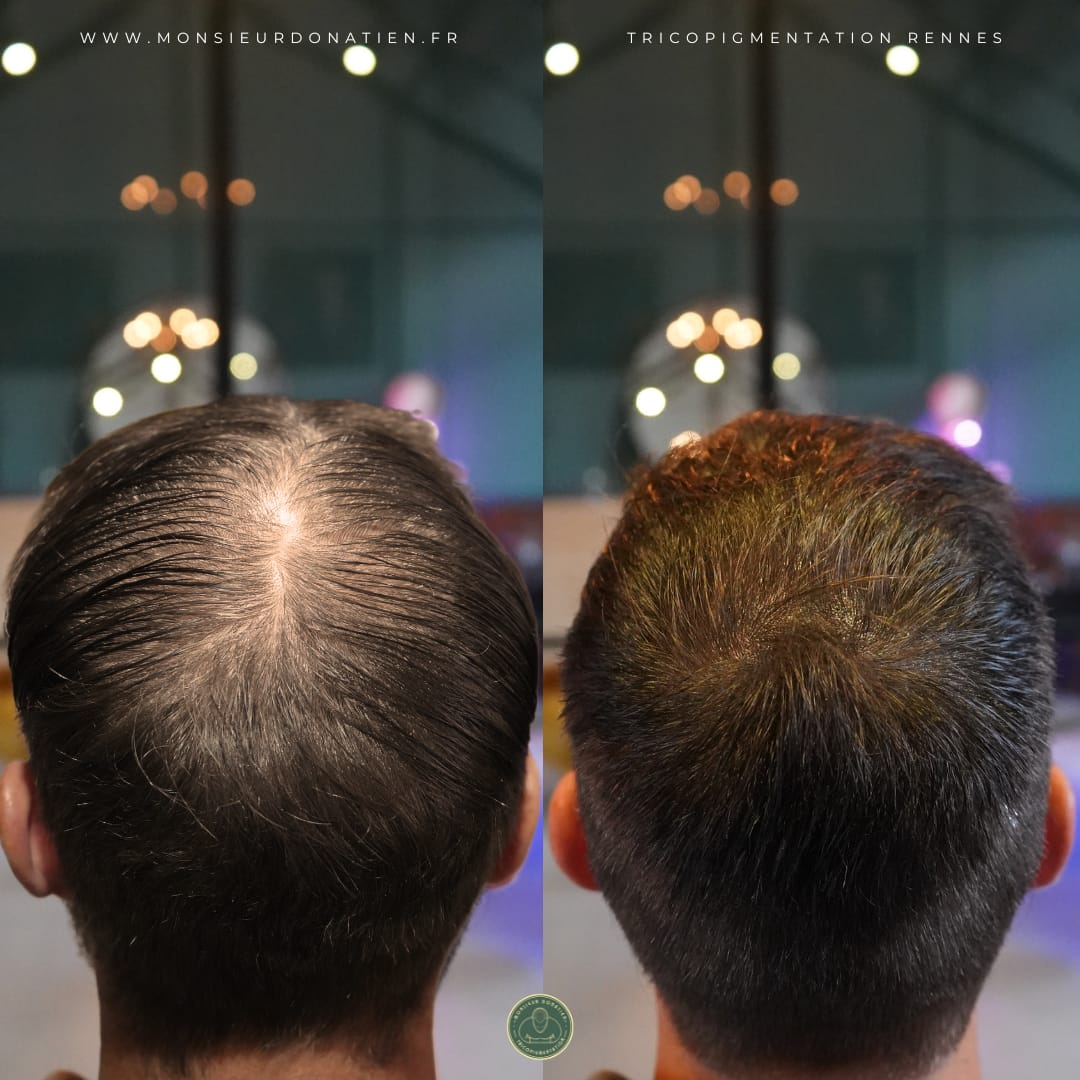 Résultat Effet Densité