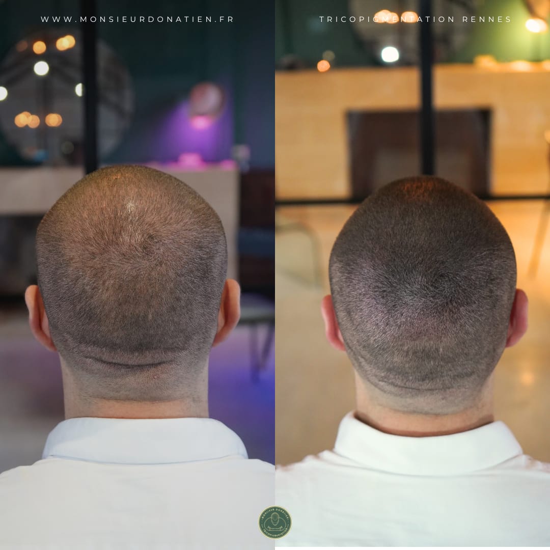 La solution pour retrouver de la profondeur