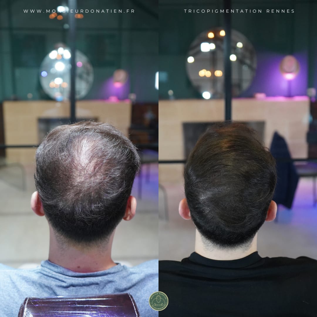 Densification capillaire : quand le style devient une réalité