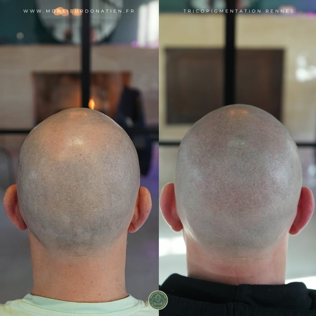 L&rsquo;effet rasé qui a conquis un footballeur de D1