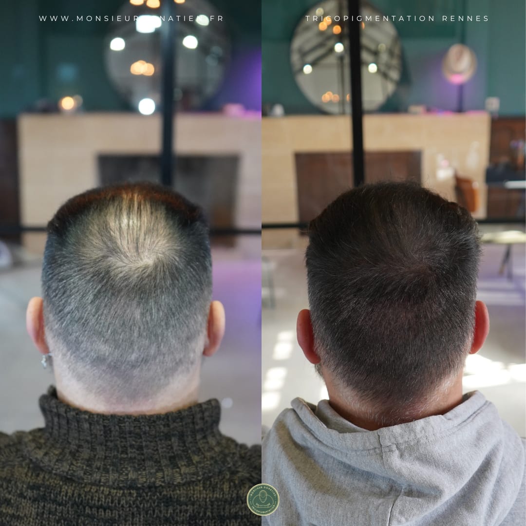 Résultat Effet Densité