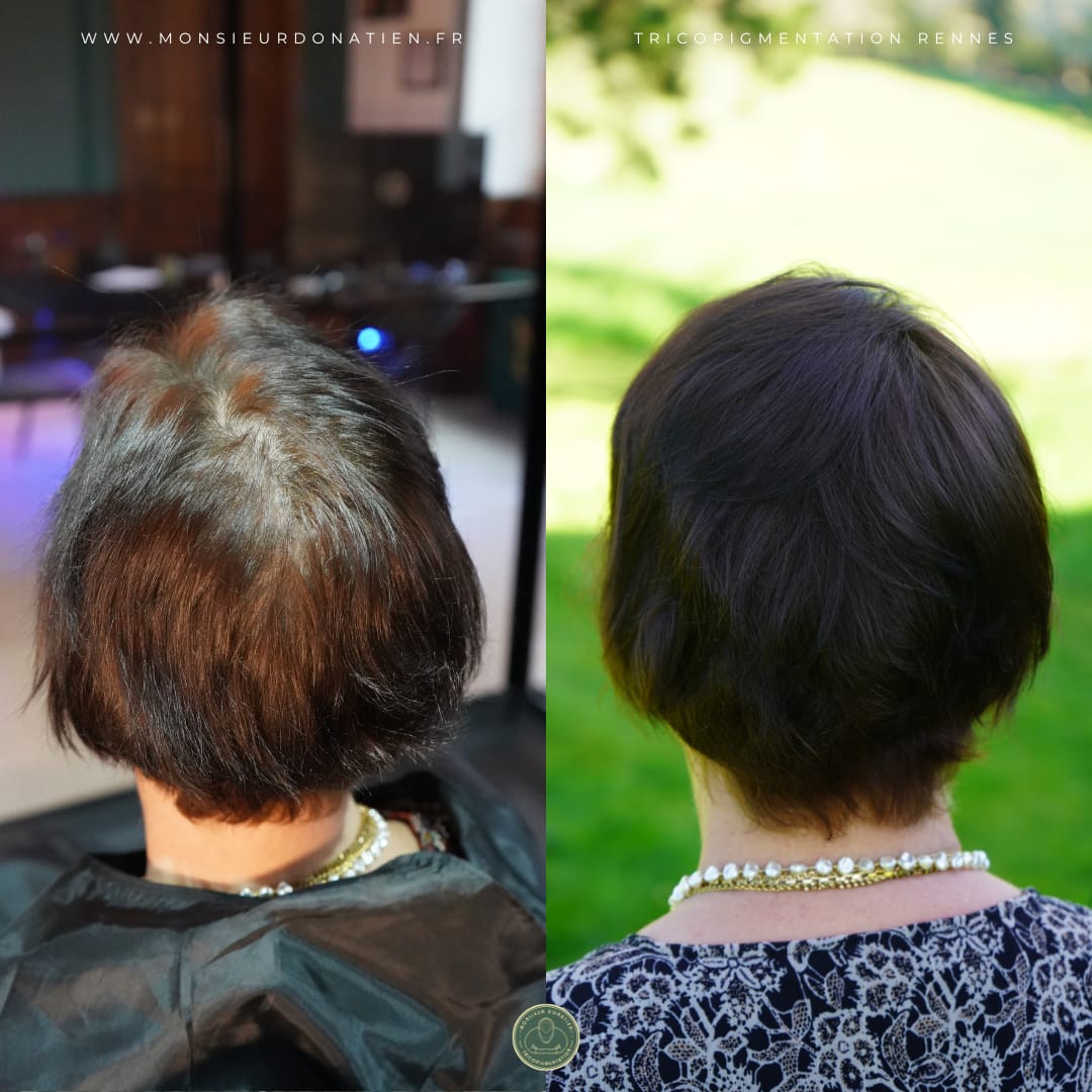 Effet Densité Féminin