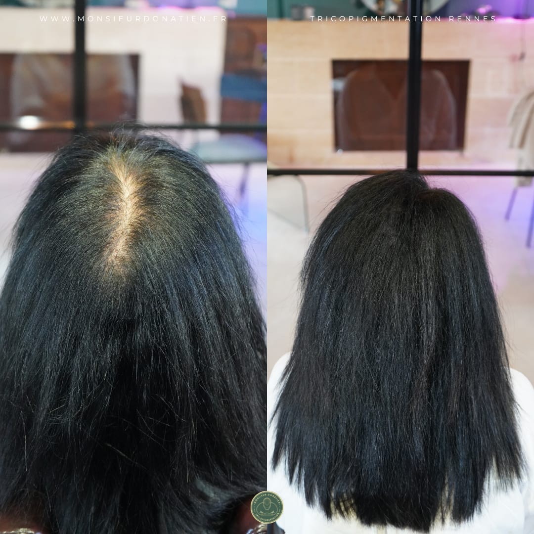 Tricopigmentation femme : une solution méconnue pour redonner du volume