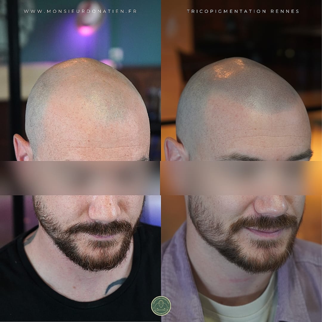 Résultat d&rsquo;un effet rasé