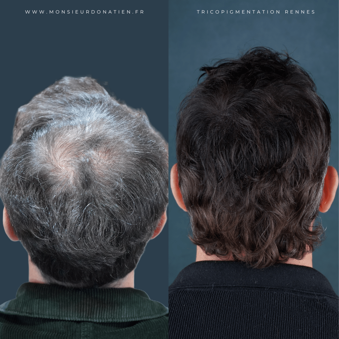 Redonner du volume aux cheveux fins sans chirurgie