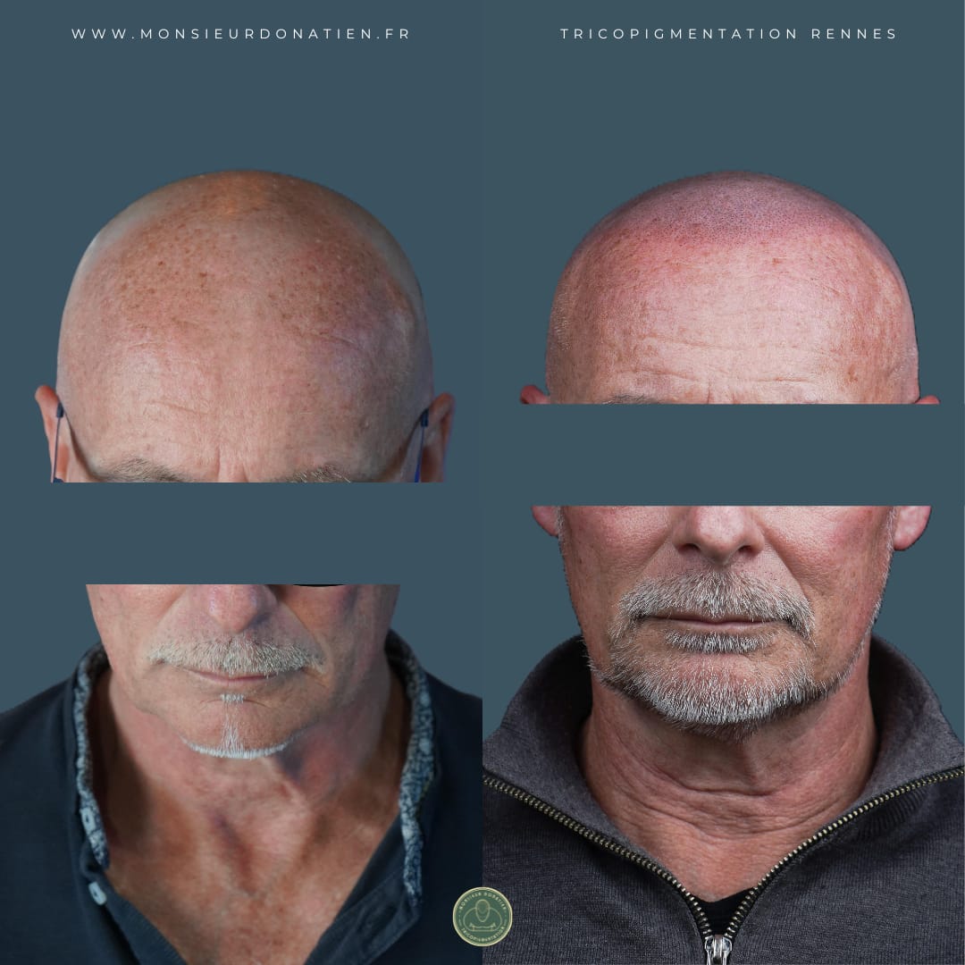 Retrouver une apparence plus jeune grâce à l’effet rasé