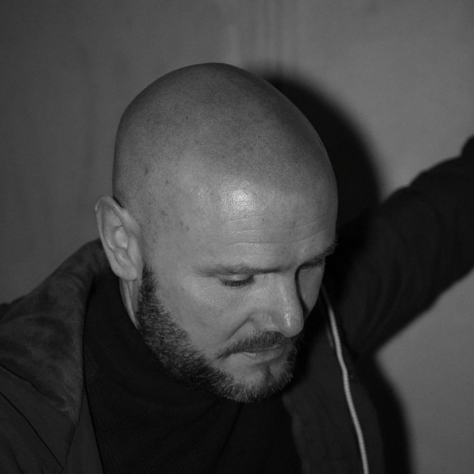 Camouflage des taches de soleil grâce à la micropigmentation