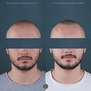 Comparatif avant après effet rasé