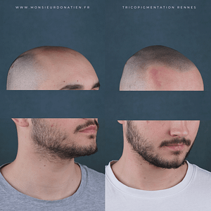 Comparatif vertex densifié